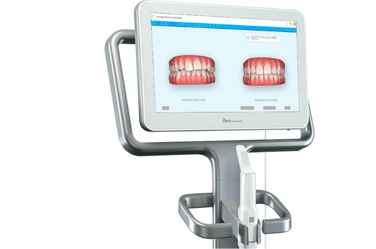 Teeth Whitening